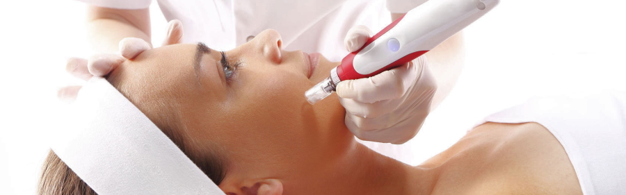 microneedling